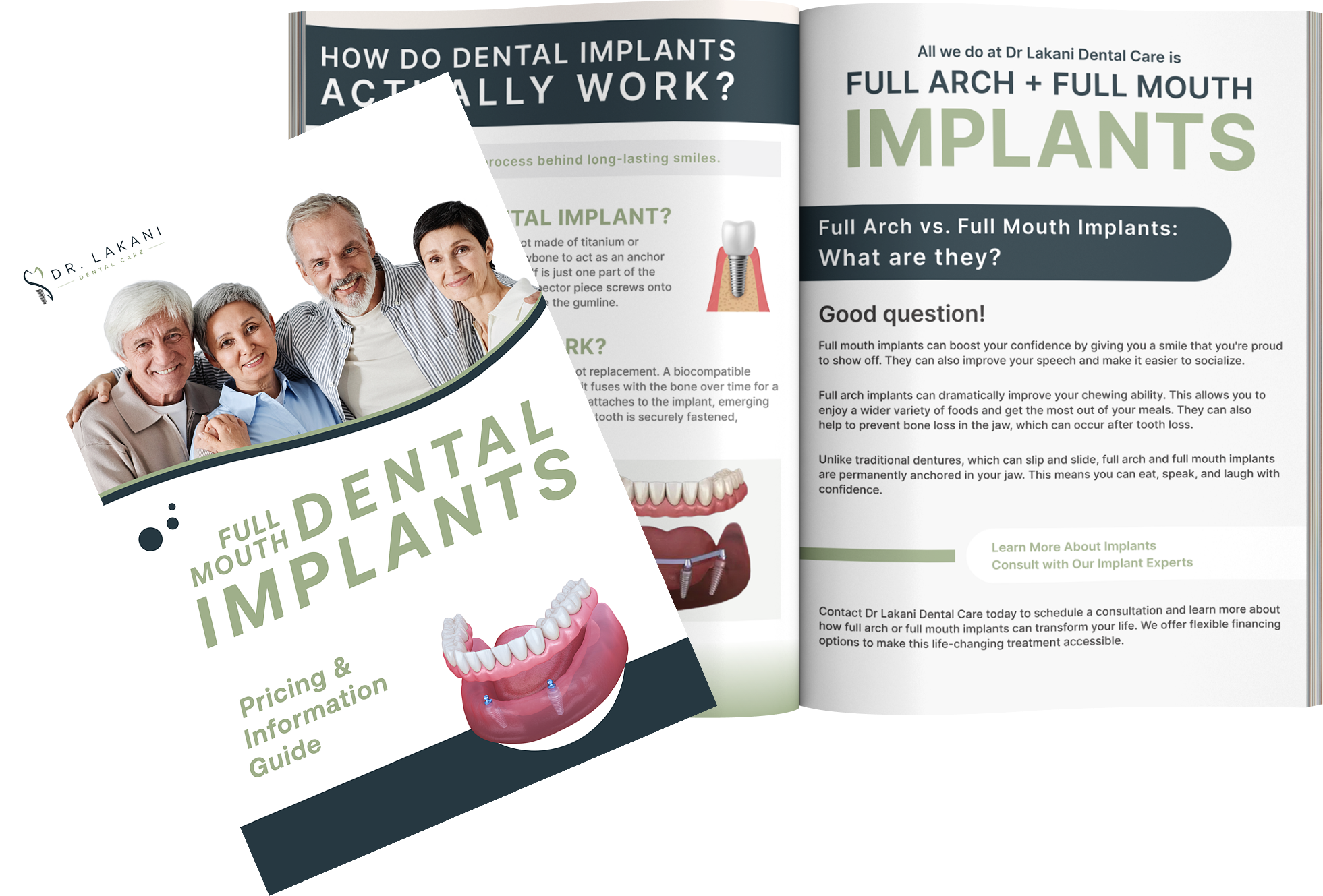 Implants Guide Book